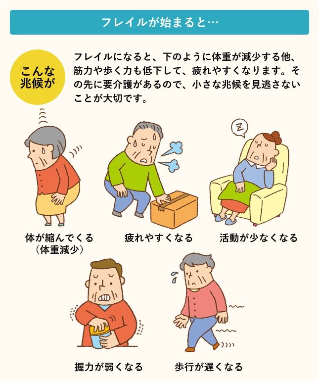 フレイルが始まると.../フレイルになると、体重が減少する他、筋力や歩く力も低下して、疲れやすくなります。その先に要介護があるので、小さな兆候を見逃さないことが大切です。/こんな兆候が:体が縮んでくる(体重減少)・疲れやすくなる・活動が少なくなる・握力が弱くなる・歩行が遅くなる
