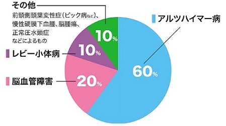 アルツハイマー病60％、脳血管障害20％、レビー小体病10％、その他10％